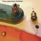 Kesztyűpatent nyomó fej/ aparát, 12,5 mm-es patenthez. 4 részes  szett .